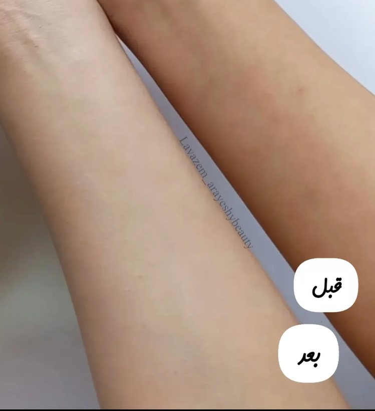 ضدآفتاب روشن کننده