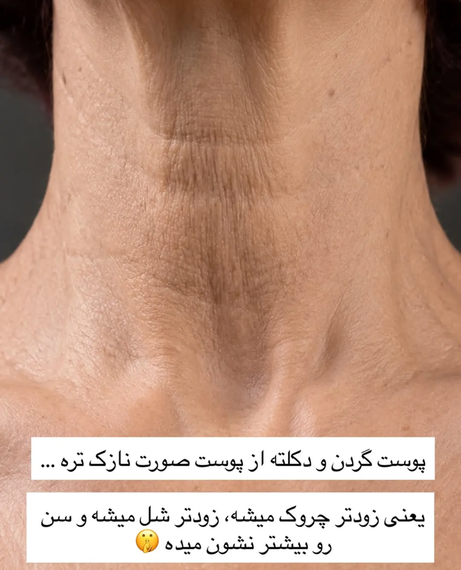 کرم لیفت غبغب و گردن و زاویه فک و صورت از برند سادور اورجینال